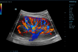 Mindray ZONE Sonography® Technology