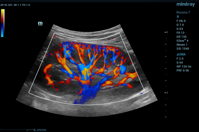Mindray ZONE Sonography® Technology