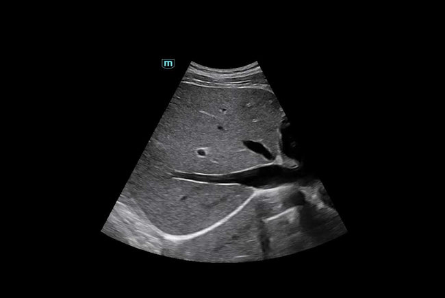 Mindray Consona N9 Ultrasound Machine (72-Month Subscription)