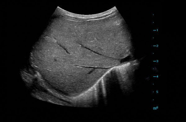 Mindray TE X Portable Ultrasound System
