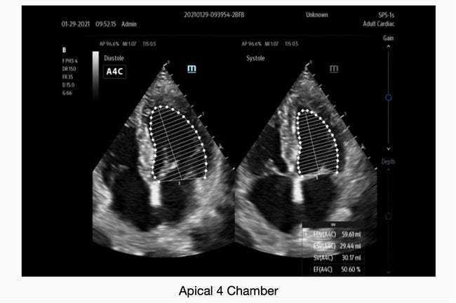 Mindray TE7 Max Point of Care Ultrasound