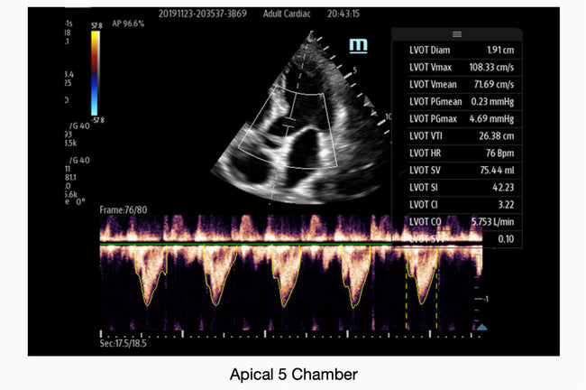 Mindray TE7 Max Point of Care Ultrasound