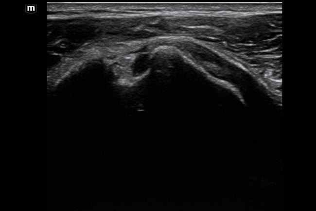 Mindray MX8 Portable Ultrasound Machine