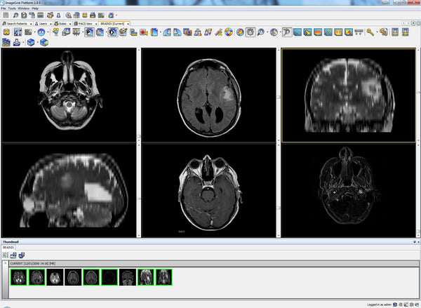 ImageGrid Mini PACS System iMD-2 1.8TB