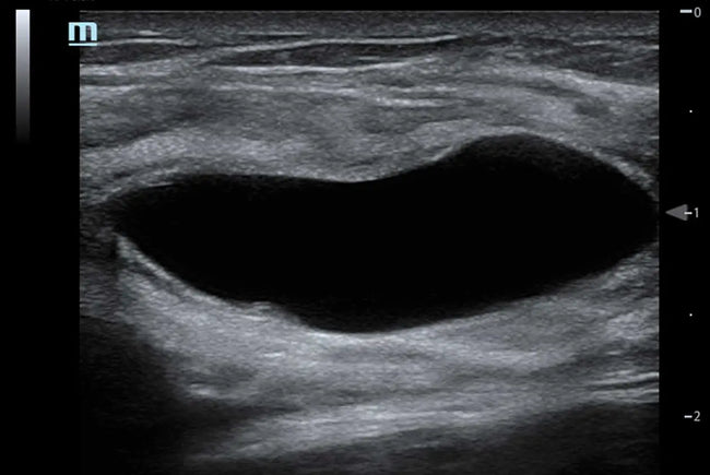 Mindray TE5 Ultrasound System