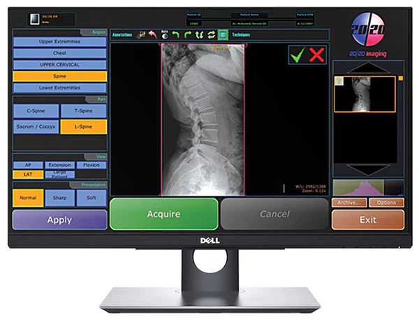 20/20 CFPT Tethered 17x17 Chiropractic Direct Digital Imaging System - DR Panel