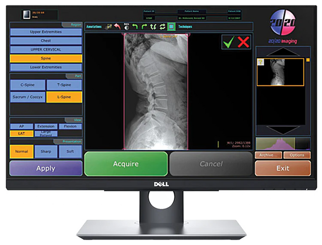 20/20 CFPW Wireless 14x17 CHIROPRACTIC Direct Digital Imaging System - DR Panel