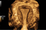 Mindray Imagyn I9 - Ultrasound Imaging