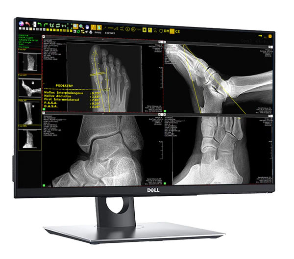 20/20 Imaging PXS-710D w/ choice of DR panel