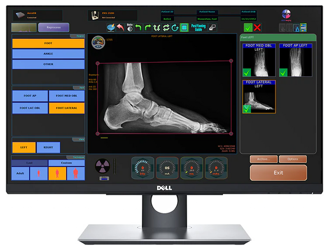 20/20 Imaging PXS-710D w/ choice of DR panel