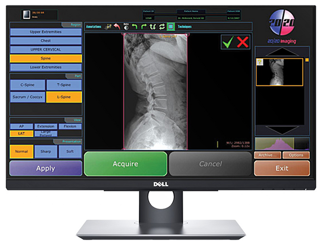 20/20 CFPH Hybrid 17x17 Chiropractic Direct Digital Imaging System - DR Panel