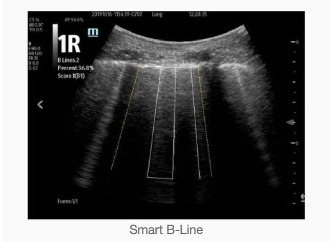 Mindray TE7 Ultrasound System Crystal Series 2.0