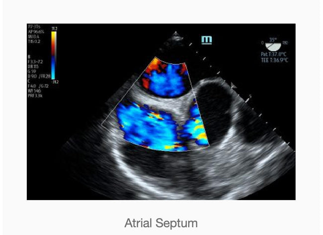 Mindray TE7 Ultrasound System Crystal Series 2.0