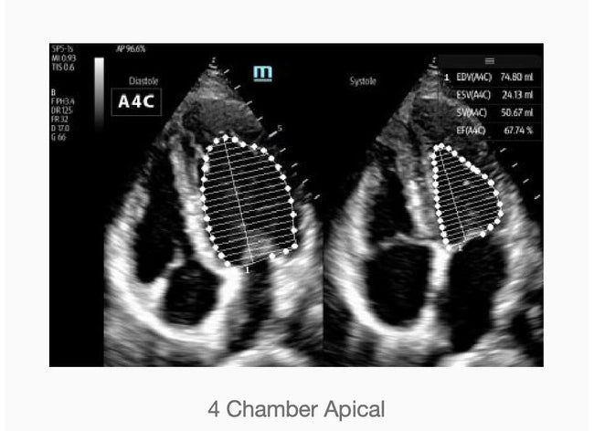 Mindray TE7 Ultrasound System Crystal Series 2.0