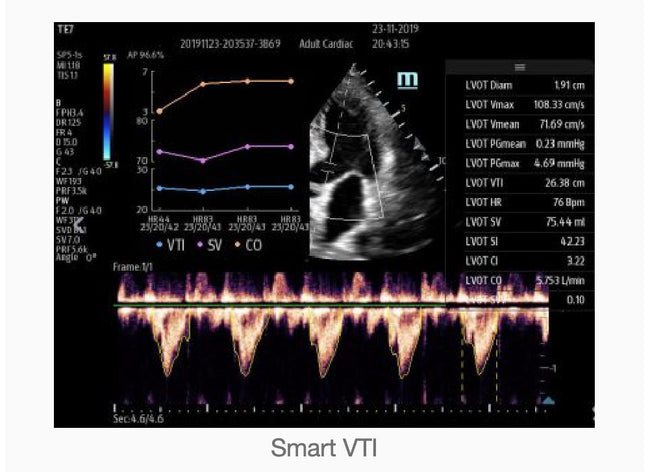 Mindray TE7 Ultrasound System Crystal Series 2.0