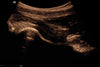 Mindray MX8 Portable Ultrasound Machine