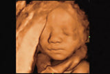 Mindray Imagyn I9 - Ultrasound Imaging