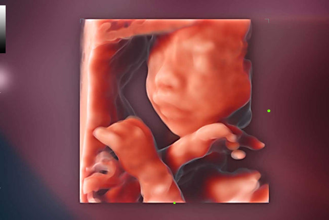 Mindray Consona N9 Ultrasound Machine (72-Month Subscription)