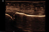 Mindray MX8 Portable Ultrasound Machine