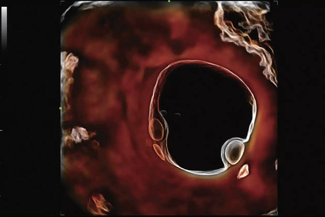 Mindray Imagyn I9 - Ultrasound Imaging