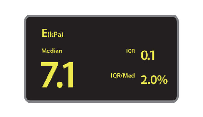 Mindray Ultrasound System Hepatus 5 - Series