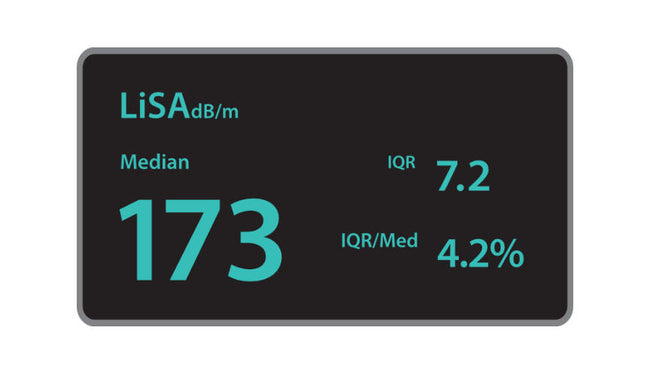 Mindray Ultrasound System Hepatus 6 - Series