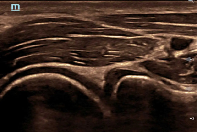 Mindray TE5 Ultrasound System