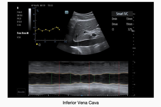 Mindray TE7 Max Point of Care Ultrasound