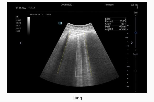 Mindray TE7 Max Point of Care Ultrasound
