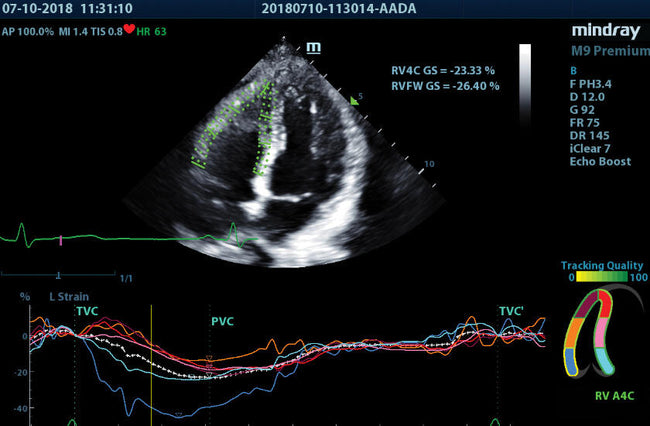 Mindray M9 Premium Ultrasound System