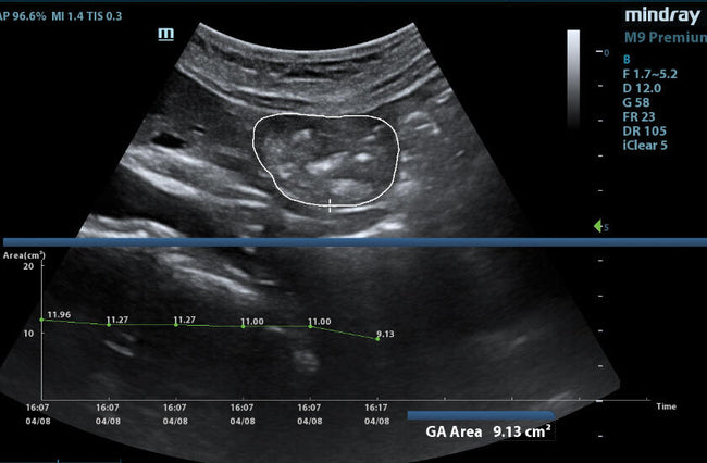 Mindray M9 Premium Ultrasound System