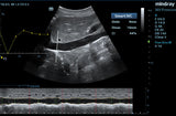 Mindray M9 Premium Ultrasound System