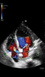 TE Air i3P Handheld Ultrasound Machine