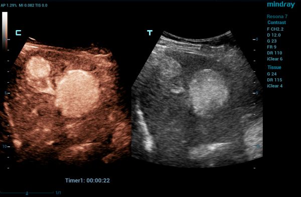 Mindray Resona 7 Platinum Edition Ultrasound System