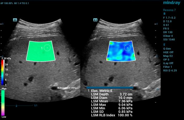 Mindray Resona 7 Platinum Edition Ultrasound System