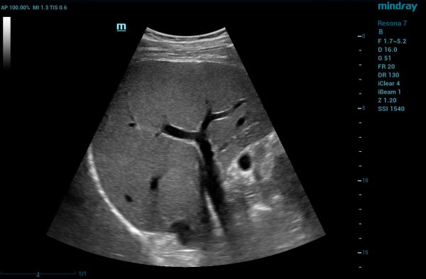 Mindray Resona 7 Platinum Edition Ultrasound System