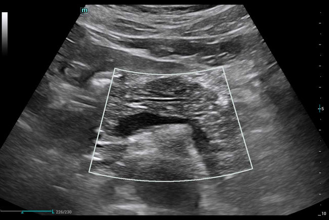 Mindray Consona N9 Ultrasound Machine (72-Month Subscription)