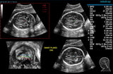 Mindray ZONE Sonography® Technology