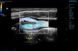Mindray ZONE Sonography® Technology