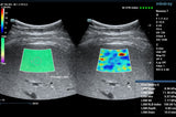 Mindray ZONE Sonography® Technology