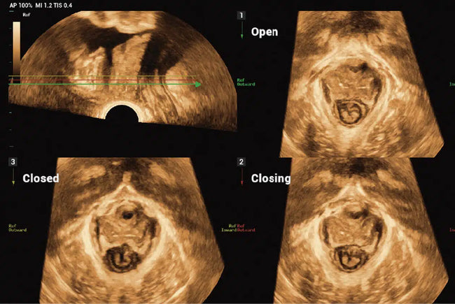 Mindray Imagyn I9 - Ultrasound Imaging