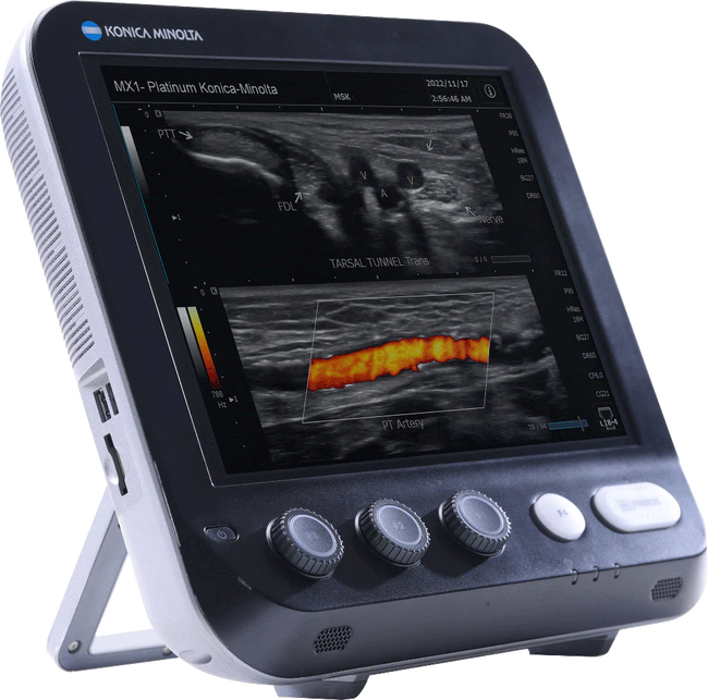 Sonimage MX1 Platinum