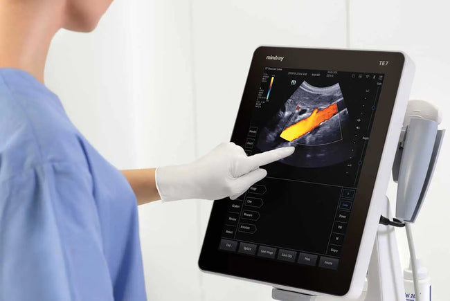 Mindray TE5 Ultrasound System