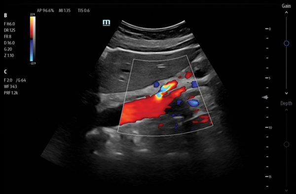 Mindray TE7 Max T Ultrasound