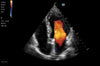 Mindray TE7 Max Point of Care Ultrasound