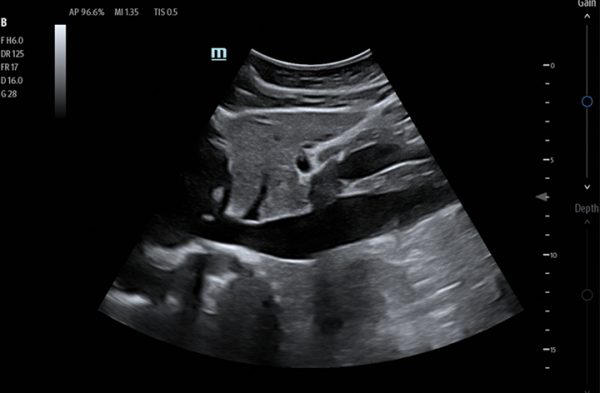 Mindray TE7 Max T Ultrasound