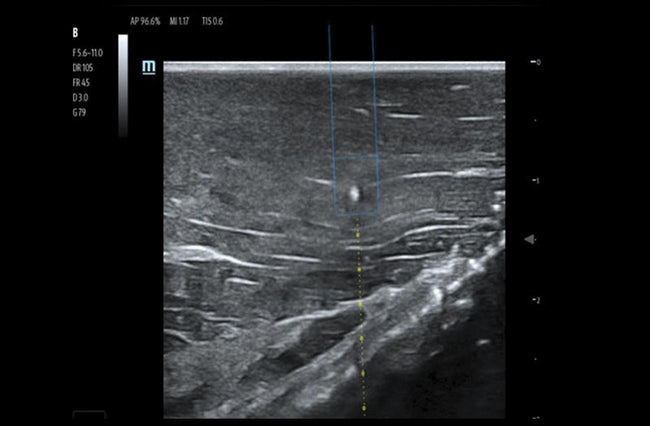 Mindray TE7 Max Point of Care Ultrasound