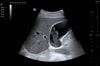 Mindray TE7 Max T Ultrasound