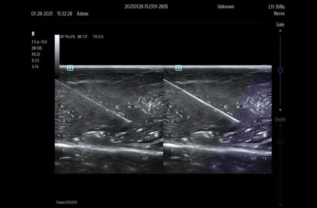 Mindray TE7 Max Point of Care Ultrasound
