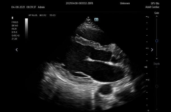 Mindray TE7 Max Point of Care Ultrasound